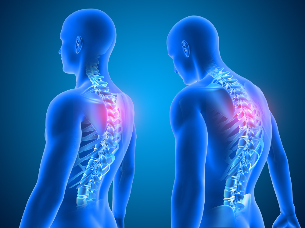 3d-render-medical-background-showing-good-poor-posture-with-spine-highlighted (1).jpg